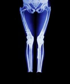 BADINKA X-Ray Skeleton Leggings